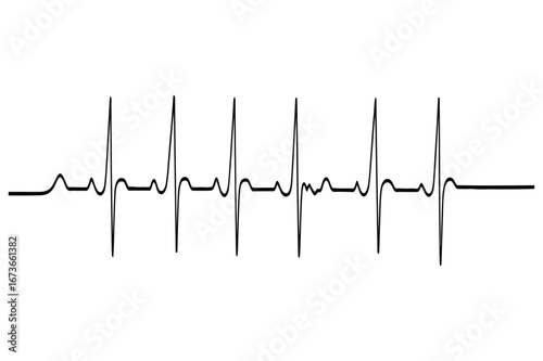 A stark black electrocardiogram line graphic on a clean white background representing a heartbeat