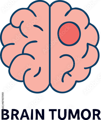 This is a flat vector illustration of a brain with a red circular spot representing a tumor, labeled "BRAIN TUMOR," symbolizing a neurological disease or medical condition.