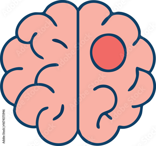 This is a flat vector illustration of a human brain with a red circular spot on one side, symbolizing a brain tumor or localized neurological issue.