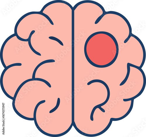 This is a flat vector illustration of a human brain with a red circular spot on one side, symbolizing a brain tumor or localized neurological issue.