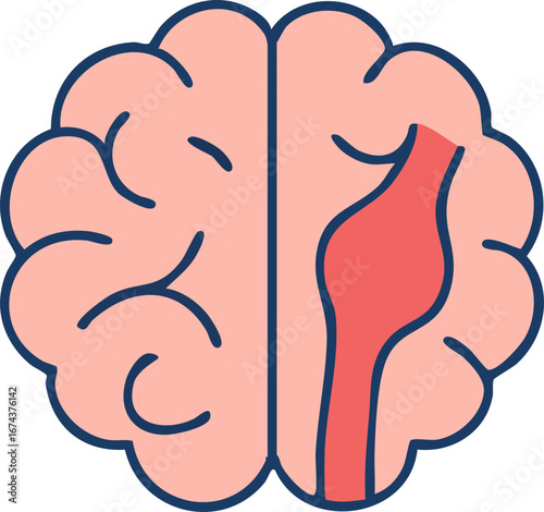 This is a flat vector illustration of a human brain with a highlighted red bulging blood vessel on the right side, representing a brain aneurysm.