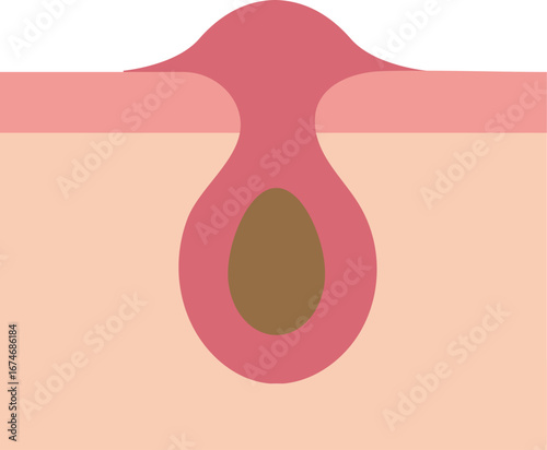 피부