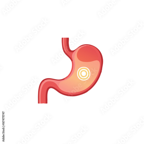 Stomach Pain Highlight Digestive System Illustration Gastric Discomfort Health Issue