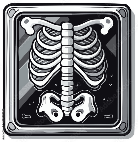 Vector Illustration of an X-Ray with Ribcage and Spine in a Box