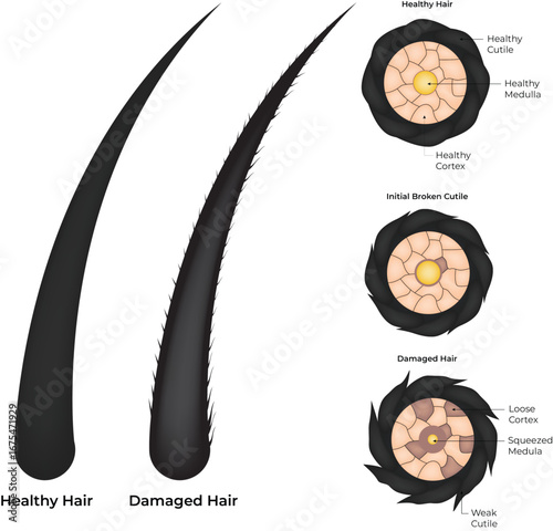 Healthy vs Damaged Hair A Comparative Visual Analysis Vector Illustration