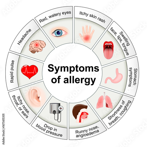 Symptoms of allergy. Histamine and local immune responses