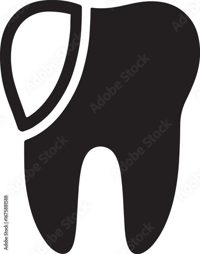Black silhouette of tooth with veneer glyph, perfect for dental, cosmetic, and oral care designs.