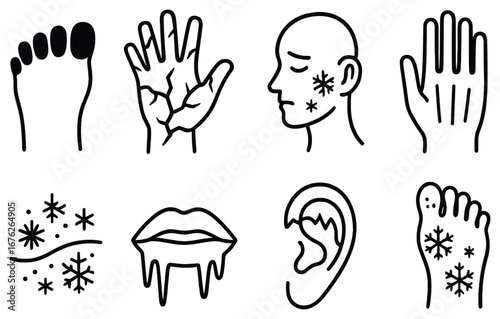 Medical conditions linear icon set. featuring dehydration, cold, frostbite, rash, cracked skin, and allergies symbols