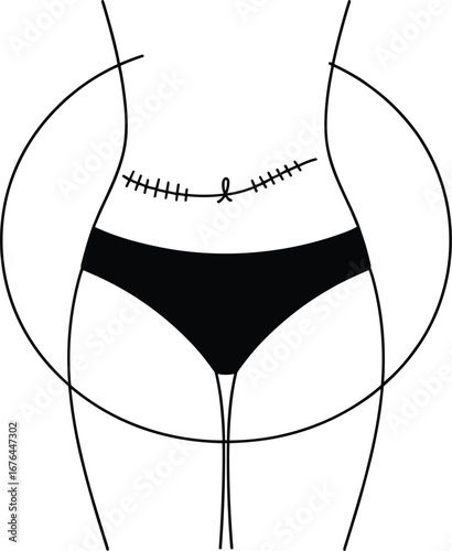 Stylized Black Outline Of A Human Torso With Surgical Scar And Underwear On White Background body surgery