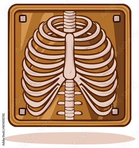 Medical Illustration of a chest x-ray on a wooden panel, cartoon style