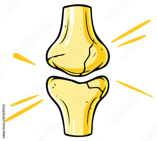 Vibrant cartoon illustration of a human knee joint with radiating lines, symbolizing pain, arthritis, or injury
