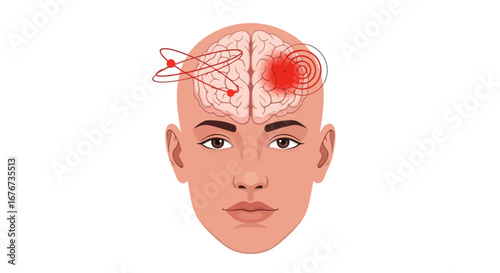 Conceptual Illustration of Human Brain Experiencing Pain and Neurological Activity, Symbolizing Migraines and Stressful