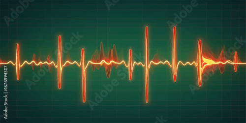 Medical electrocardiogram (ECG) monitor showing a pulsing green heartbeat line representing a healthy cardio pulse and rhythm