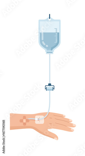 Intravenous (IV) drip infusing fluid into a patient's hand.