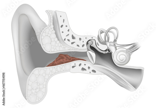 Earwax. Cross section of human ear