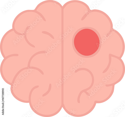 This illustration depicts a human brain with a highlighted red circular spot, symbolizing brain injury, stroke, or localized neurological damage.