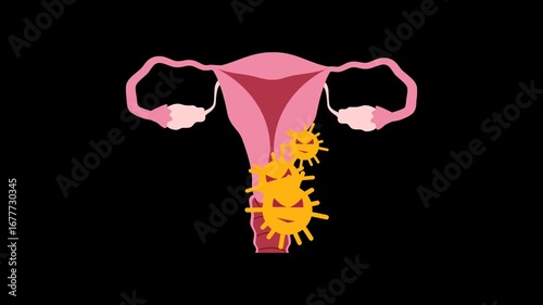 Ovarian cancer illustration animation. World ovarian cancer day concept	