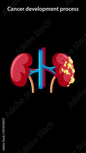 Kidney Cancer Cell Development and Proliferation Animation
