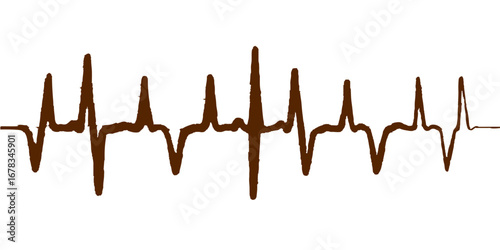 Cardiogram pulse graph showing an ekg heartbeat illustration on a medical concept chart