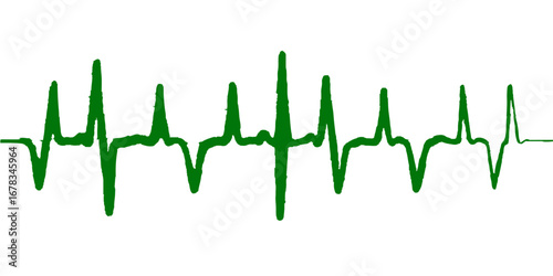 Medical graph showing the vector heartbeat sound wave on an ECG chart, a visual representation of a heart's pulse