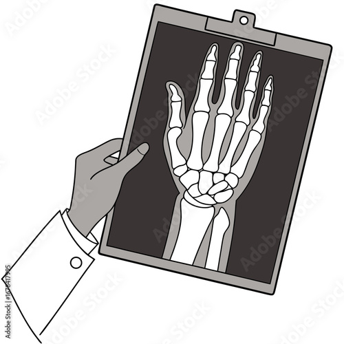 Doctor holding an x ray of a human hand and wrist bones for examination and diagnosis