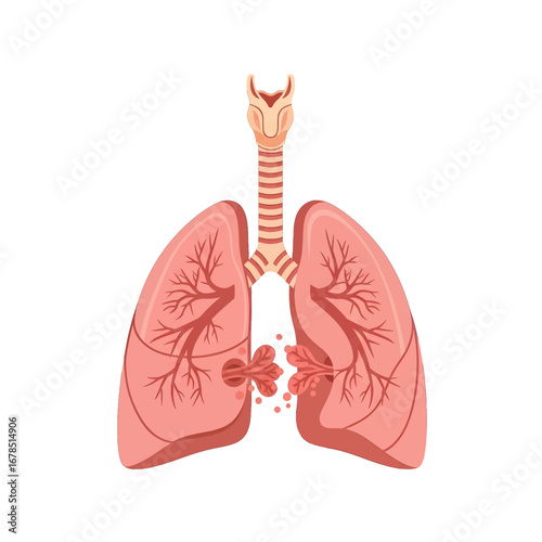 Anatomical Illustration of Lungs Affected by Cancer on White Background Showing The Respiratory System Health Issues