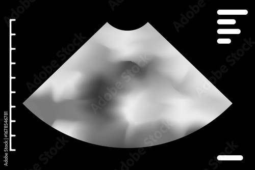 Ultrasound scan displaying medical imagery on a monitor