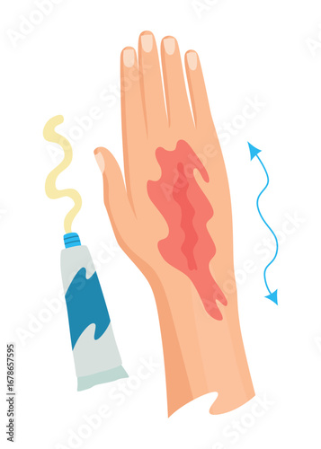 Hands injured skin and procedures of bandaging. First aid for wound. Medicine cure or treatment. First emergency help for human hand trauma