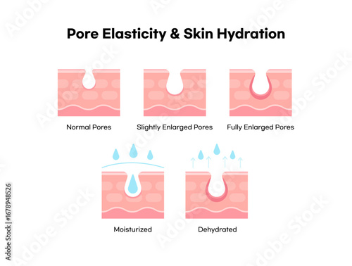 An Illustration Showing the Relationship Between Pore Elasticity and Skin Hydration.