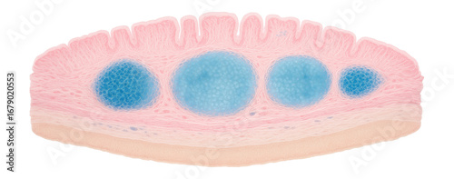 Intestinal tissue stained to show Peyer's patches in the submucosa