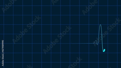 Heartbeat animation monitor simple and modern