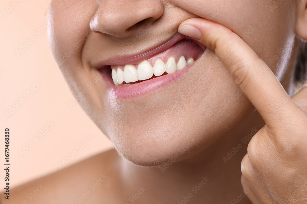 Fototapeta premium Woman showing her teeth and gums on beige background, closeup