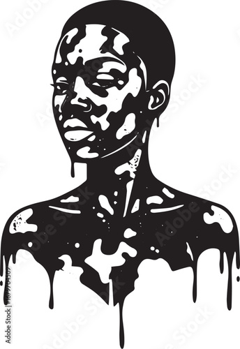 Monochrome portrait showcasing an individual with unique skin pi