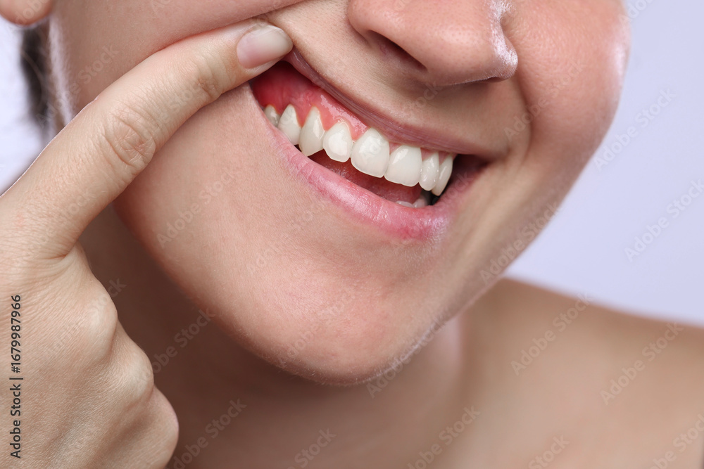 Fototapeta premium Woman showing inflamed gum on light background, closeup