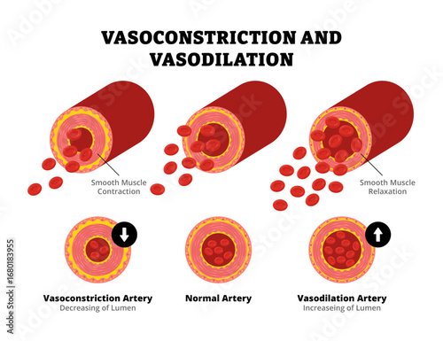 Arterial vasoconstriction and vasodilation diagram comparison with cross section view. Normal, constricted, and dilated blood vessels circulation. Cardiovascular reduction pressure. Healthcare Medical