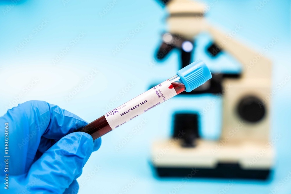 Naklejka premium Measures transferrin levels, a protein that transports iron,