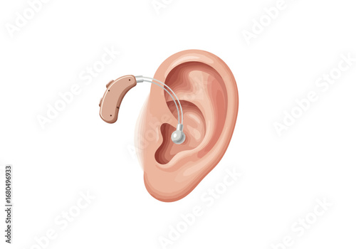 Illustration of a human ear with a hearing aid device attached