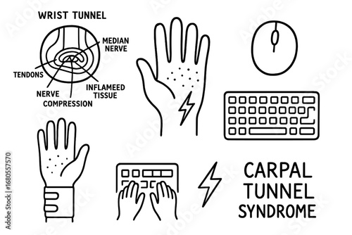 Carpal Tunnel Symptoms Icons. Hand-drawn doodle illustration carpal tunnel syndrome wrist tunnel, median nerve, tendons, nerve