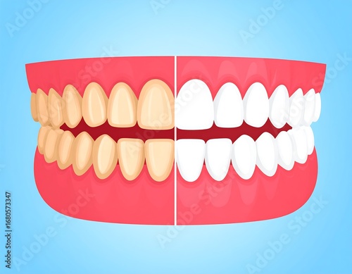 Teeth whitening comparison (1)