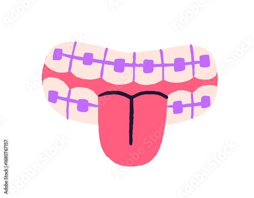 Icon of teeth with braces. Mouth with orthodontic tool. Happy smile with sticking tongue. Dental health, oral hygiene. Stomatology and dentistry. Flat isolated vector illustration on white background