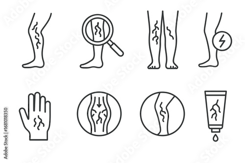 Varicose veins symptoms and treatments: leg, hand, cream icons