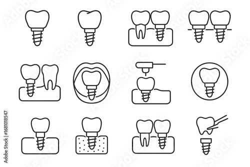 Dental implant icons: single and multiple tooth replacement illustrations