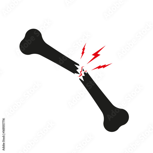 Broken bone icon with jagged fracture and red pain lines, symbolizing injury or trauma. Ideal for medical, emergency, or health-related visuals.