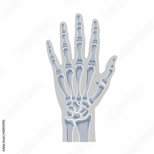 Hand X-Ray Bones