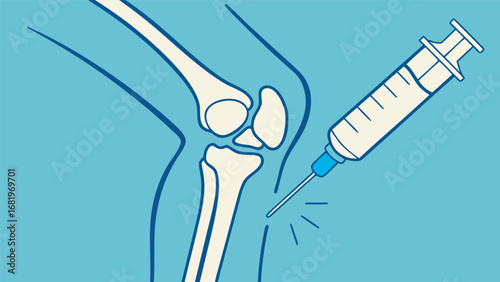 Close-up of knee joint injection procedure with syringe administering medication