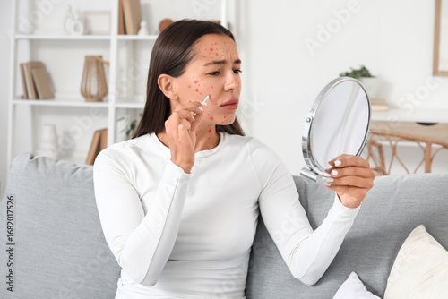 Young woman ill with chicke...