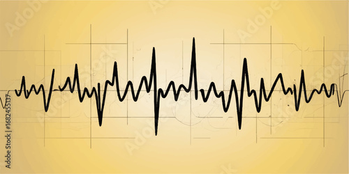 Vector medical illustration of a green heartbeat on a cardiogram chart