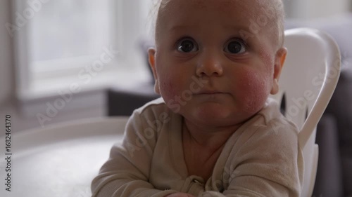 Infant boy with eczema scratching rash on arm - tilt up to look directly into camera