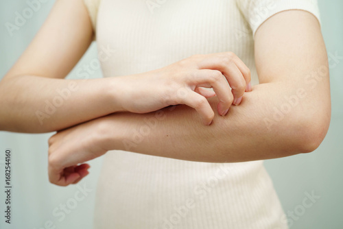 Wallpaper Mural Asian woman itching of skin diseases using hand scratching. Torontodigital.ca