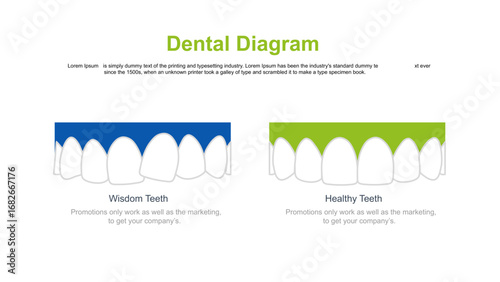 Dental Diagram Overview of Dental Procedures